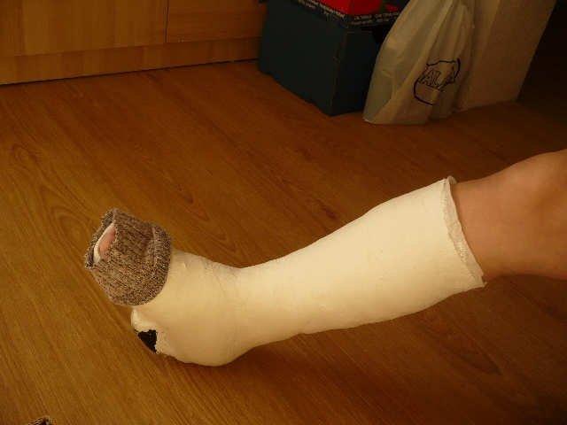 kalisa...gips