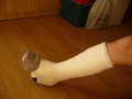 kalisa...gips